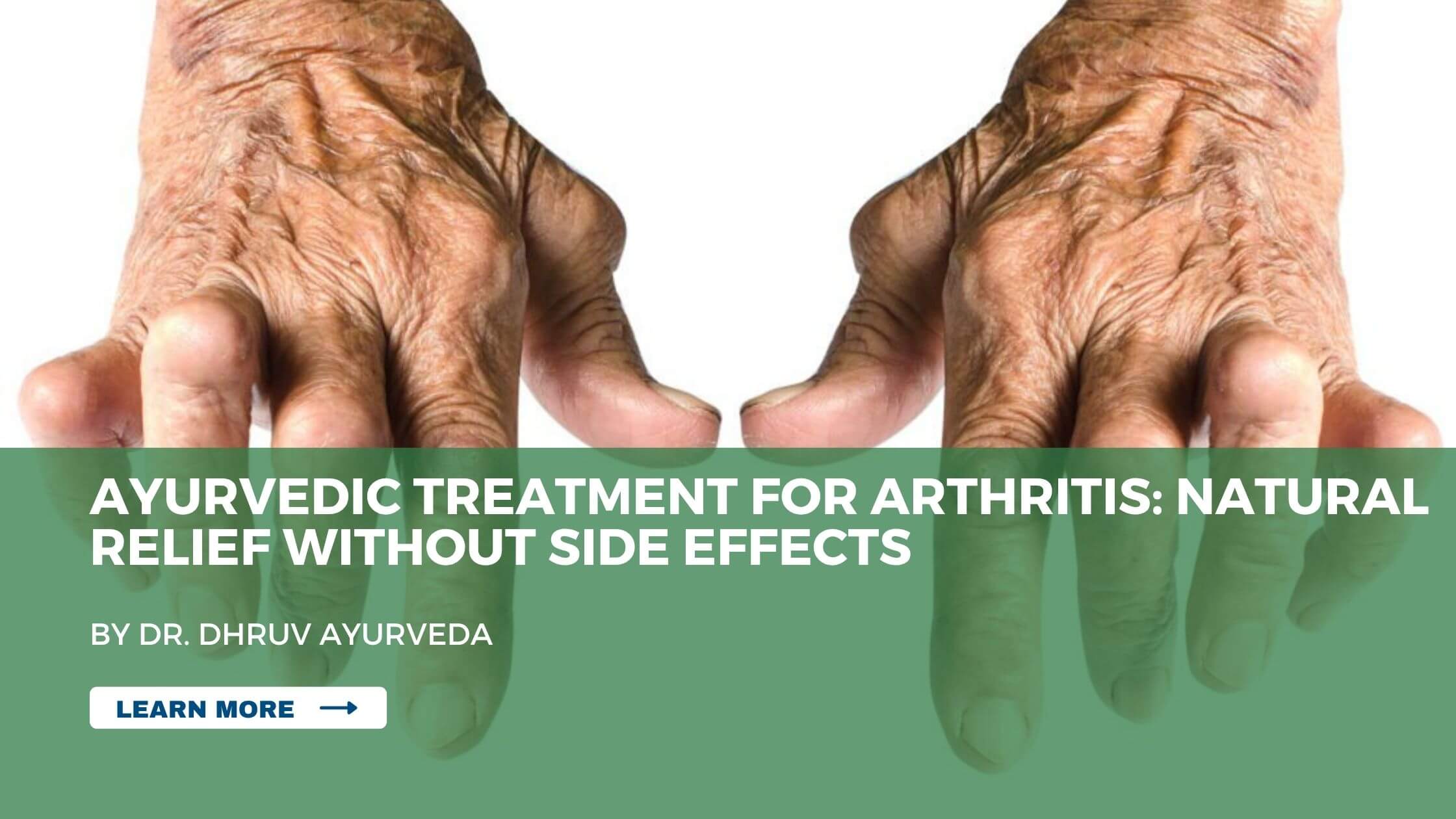 Ayurvedic Treatment for Arthritis: Natural Relief Without Side Effects