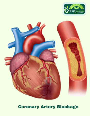 Ayurvedic clinic in Lucknow